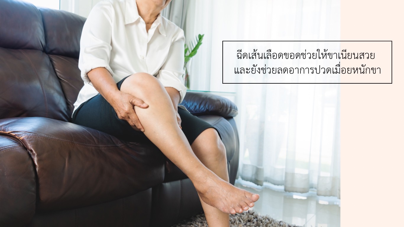 ฉีดเส้นเลือดขอดช่วยอะไร