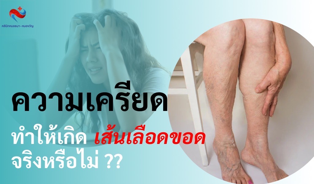 ความเครียดกับเส้นเลือดขอด