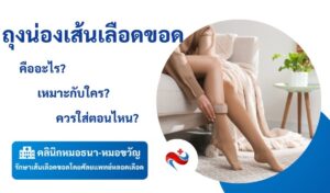 ถุงน่องเส้นเลือดขอด คืออะไร เหมาะกับใคร