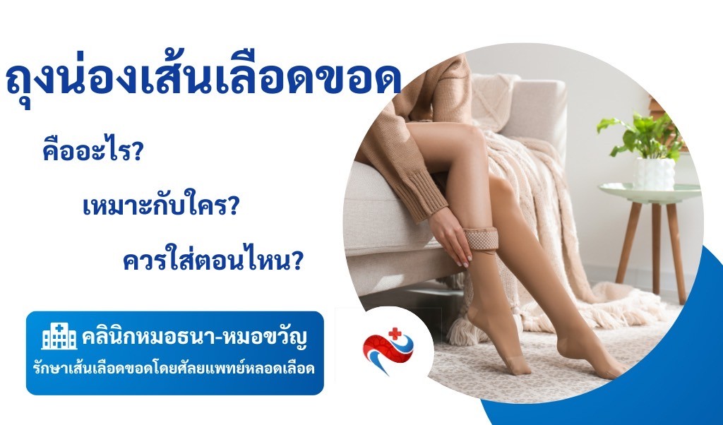 ถุงน่องเส้นเลือดขอด คืออะไร เหมาะกับใคร
