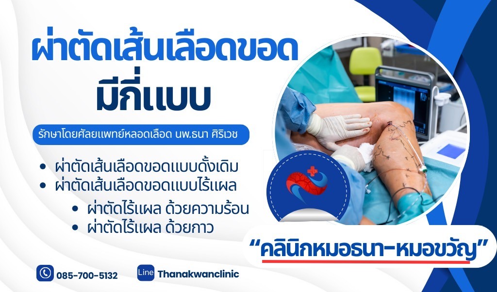 ผ่าตัดเส้นเลือดขอดมีกี่แบบ