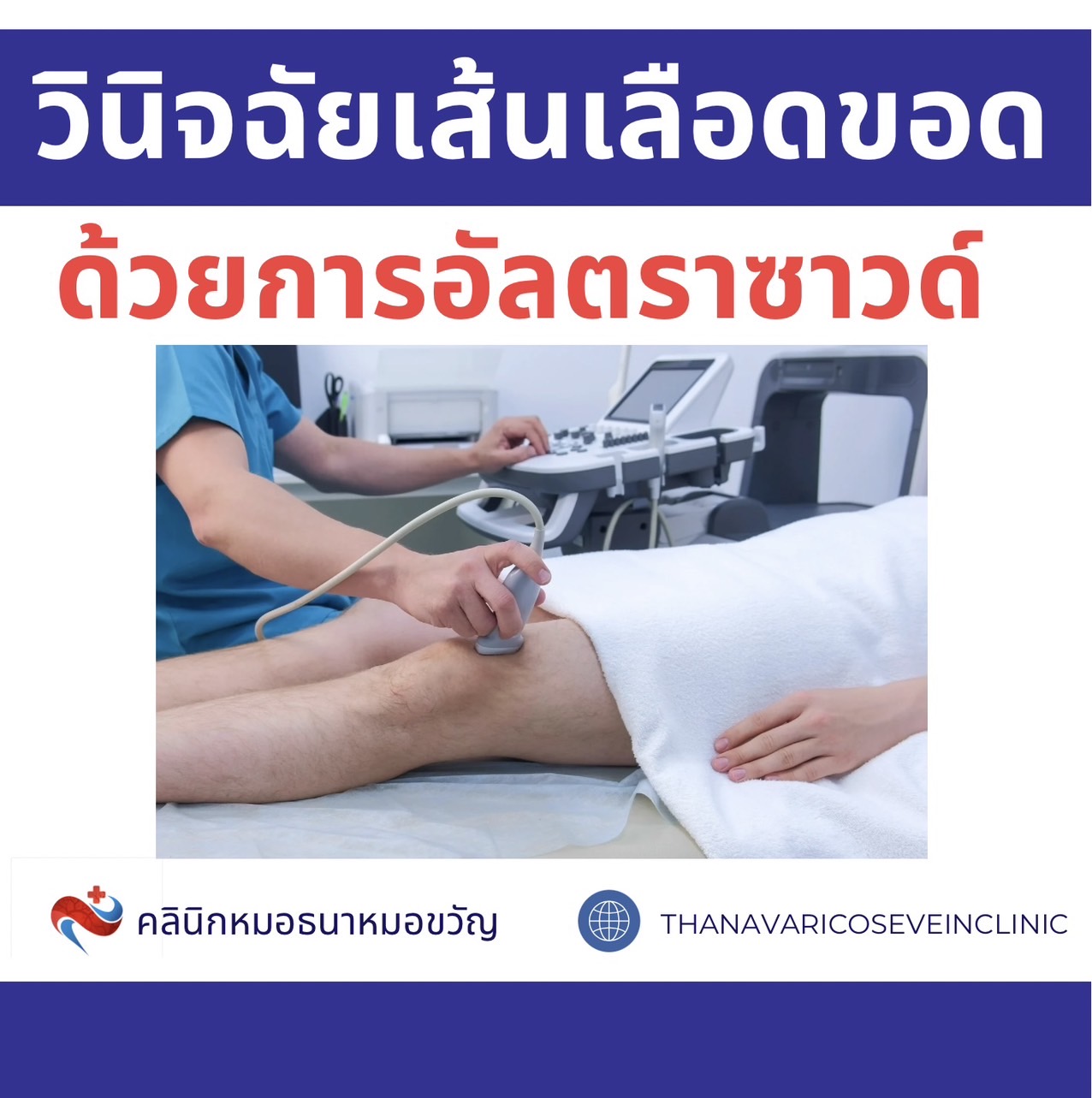 การวินิจฉัยเส้นเลือดขอด