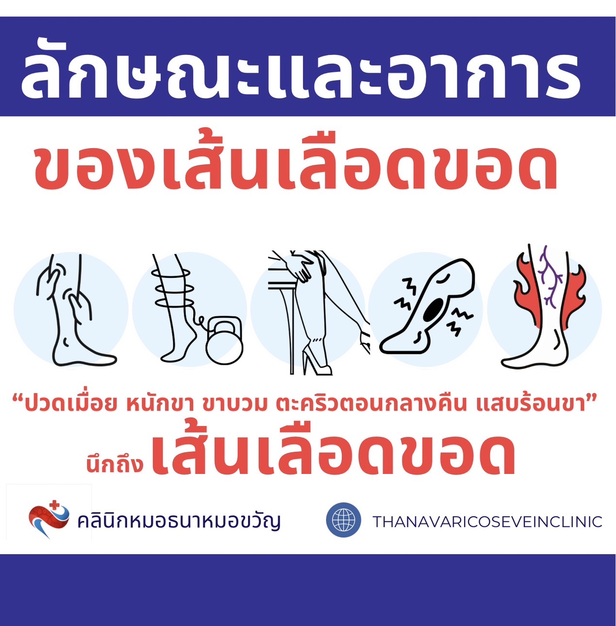 ลักษณะและอาการของเส้นเลือดขอด