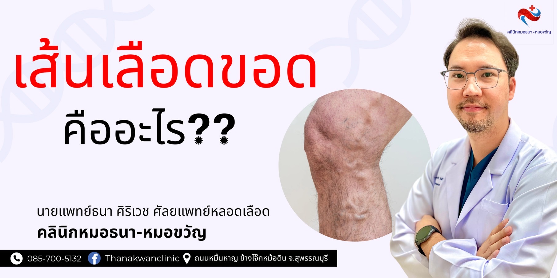 เส้นเลือดขอด คืออะไร