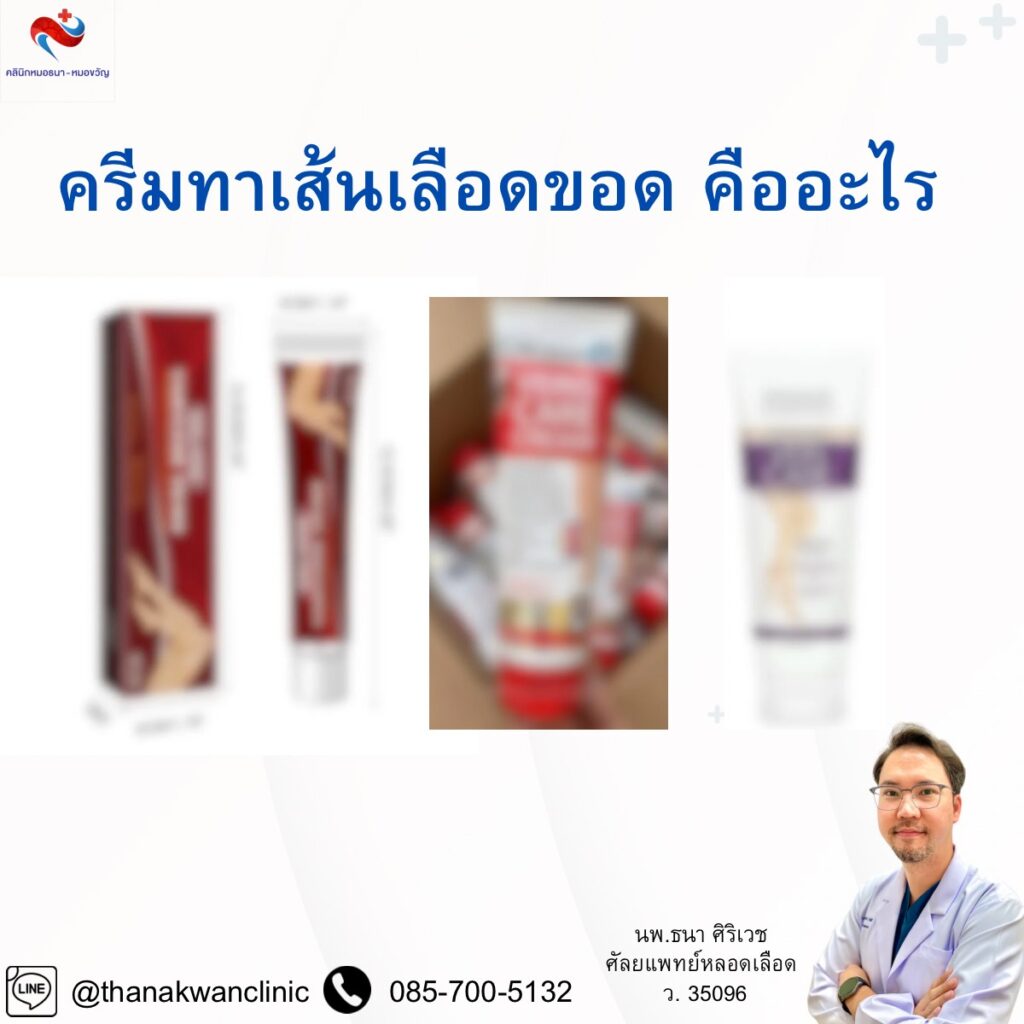 ครีมทาเส้นเลือดขอด คืออะไร