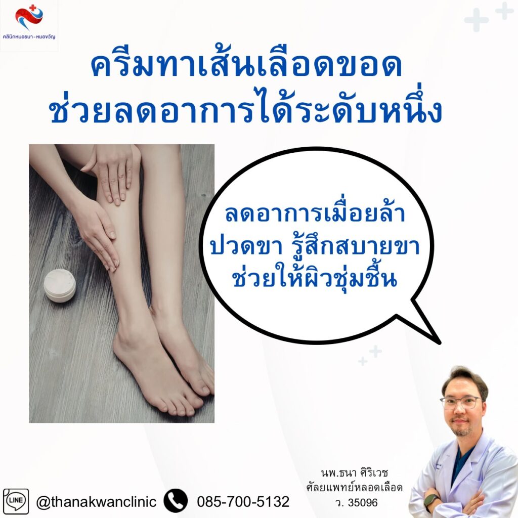 ครีมทาเส้นเลือดขอด ช่วยเรื่องอะไรบ้าง